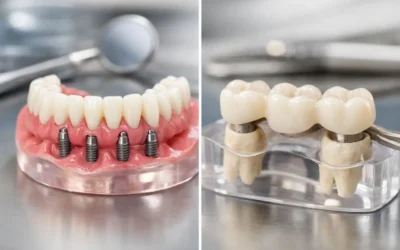 All-on-Four Versus Bridges: Which Fits You?